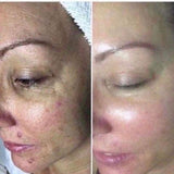 Skin Care: AHA Facial Peel and Neutralizer
