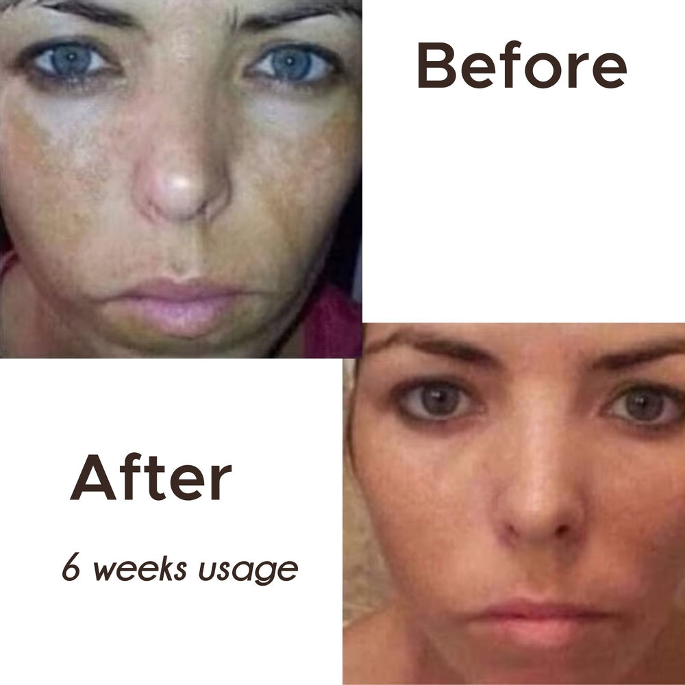 Skin Care: 180 Face Wash
